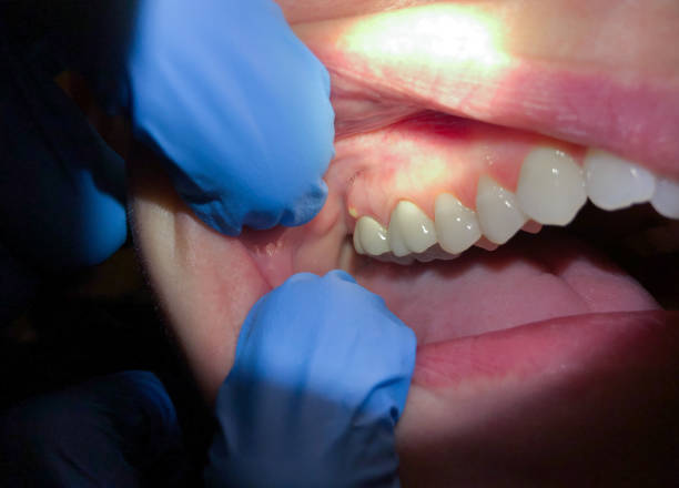 Best Tooth Infection Emergency Dentist  in Troy, MI